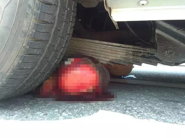 悚!女出車禍遭拖行 整塊頭皮被扯下身亡 -