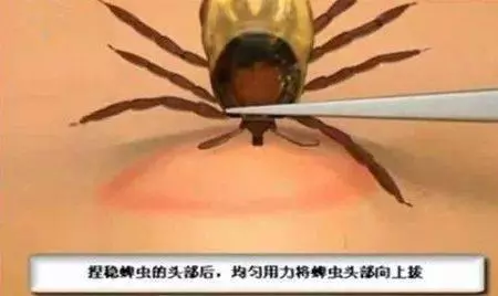 主人發現狗狗身上有蟲,用手拔出卻引發感染?別把驅蟲不當回事