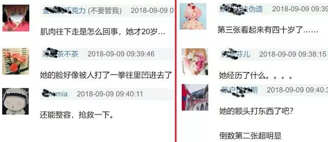 徐嬌上《我就是演員》被網友吐槽太醜,這些年她的臉經歷了什麼?