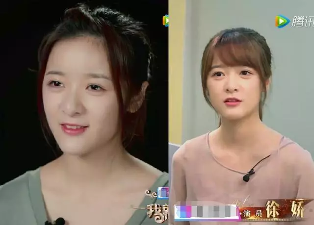 徐嬌上《我就是演員》被網友吐槽太醜,這些年她的臉經歷了什麼?