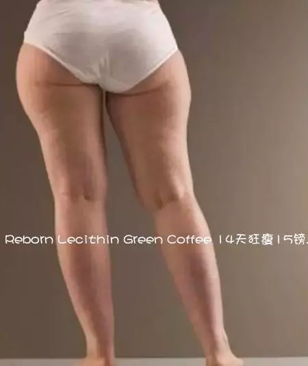 十條粗腿九不同,認清腿型再瘦腿!6個動作,速減大腿多餘脂肪!