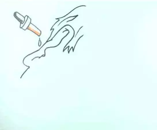 教你如何正確輕鬆清除堵塞耳朵裡的耳垢！必收藏！