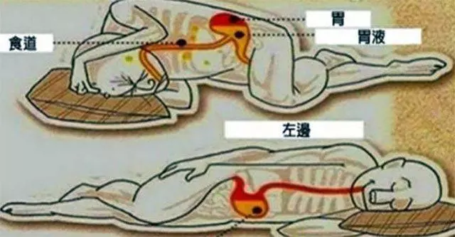 睡覺躺左側還是右側?躺錯方向容易造成淋巴堵塞,躺對方向能長壽
