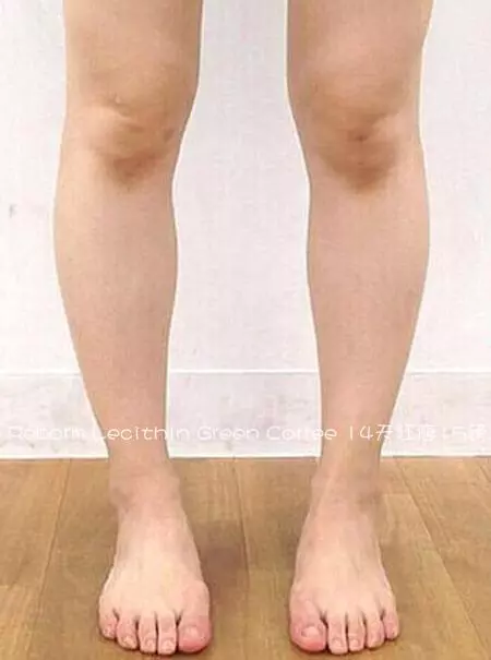 腿型不正,大腿粗,小腿肌肉壯說的就是你!各種腿型瘦腿攻略!