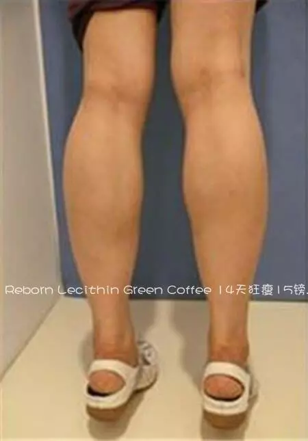 腿型不正,大腿粗,小腿肌肉壯說的就是你!各種腿型瘦腿攻略!