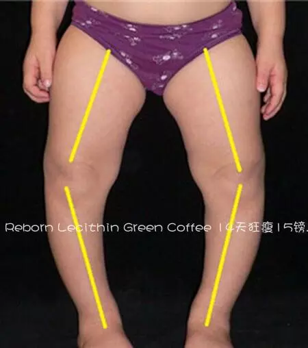 腿型不正,大腿粗,小腿肌肉壯說的就是你!各種腿型瘦腿攻略!