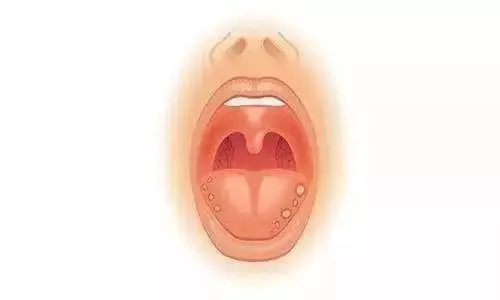 口腔潰瘍沒完沒了?腳心處貼點它,比吃藥見效快!收藏隨時看!