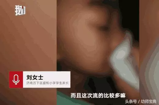 70多個小學生「流鼻血」,校方做出回應,家長:哪有這麼巧?