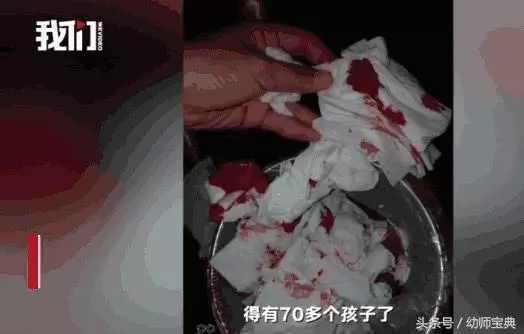 70多個小學生「流鼻血」,校方做出回應,家長:哪有這麼巧?