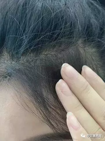 超減齡的高馬尾扎法,內附獨家調整髮際線方法!
