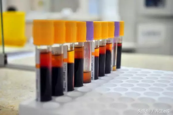 腦血管堵塞的人,3件事最好別做,3樣東西最好別碰,易患中風!