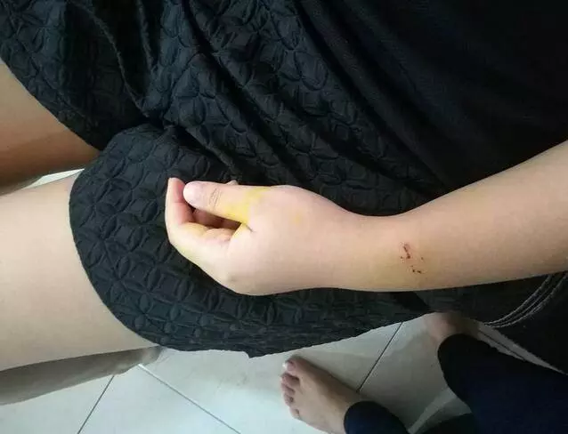 新山發生恐怖搶劫傷人案:就埋伏在你家門口,防不勝防差點出人命,保安竟然什麼都不管?