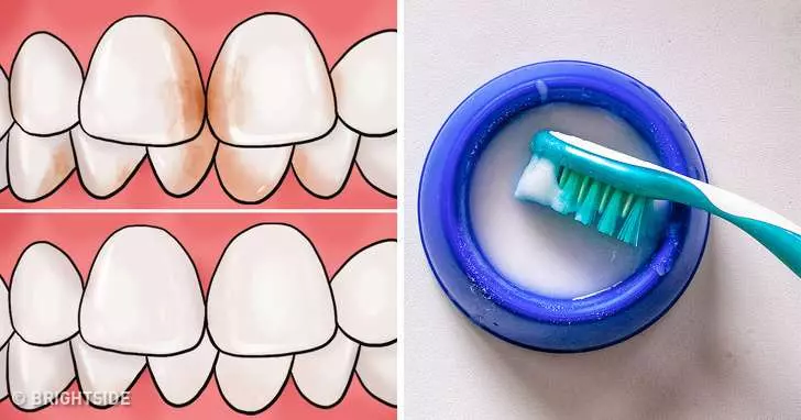 10個去牙垢妙招「還你亮白牙齒」 廢棄橘子皮有奇效!