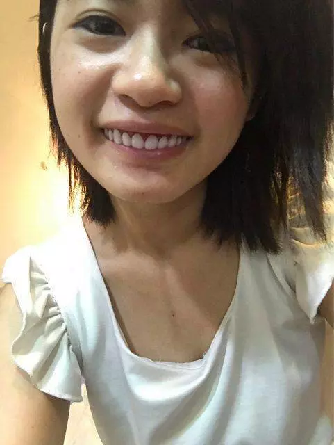 她亂買超廢「假牙玩具」…戴上去「咧嘴微笑」竟美到超過100分!網友:這東西太火了… -