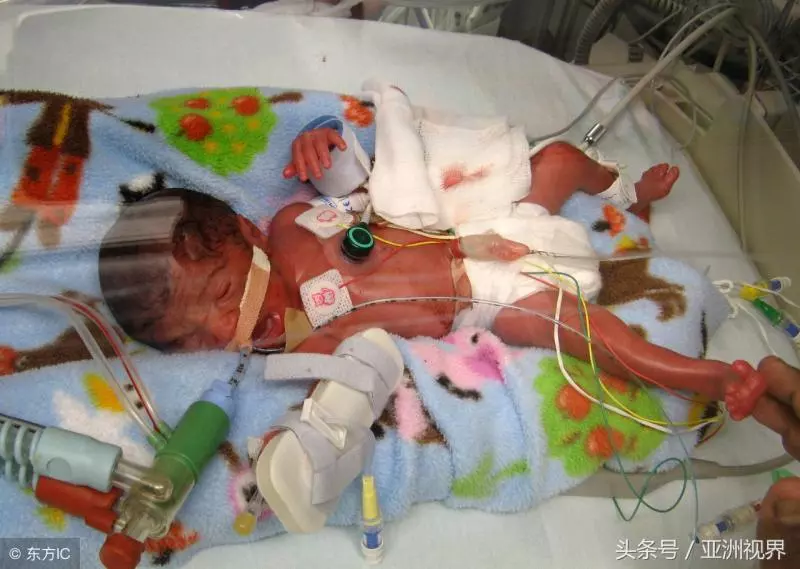 震撼!腦死亡2天,英國滑冰教練為「小丈夫」產下女嬰