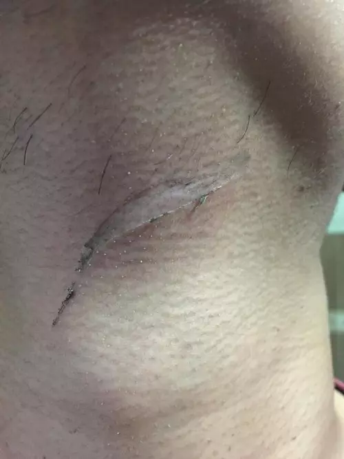 出入口暗設魚線 摩哆騎士險被割喉