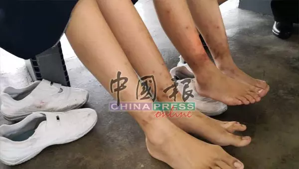 怪蟲襲擊華小 20師生全身紅腫痕癢