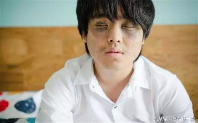 濕氣重的人,身體會有這3種「表現」,發現一個最好去查下!