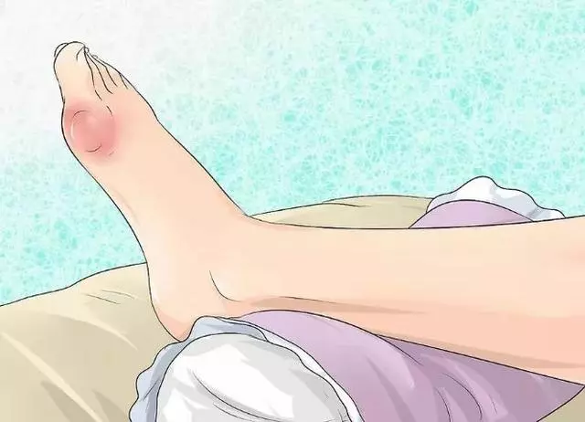 常吃花生防癌降血壓?這6類人吃了相當於「服毒」