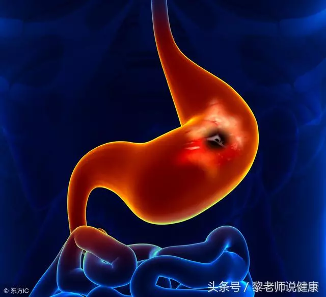 腌菜、臘肉是否致癌?這3種「習慣」才是致癌「黑手」!1分鐘科普