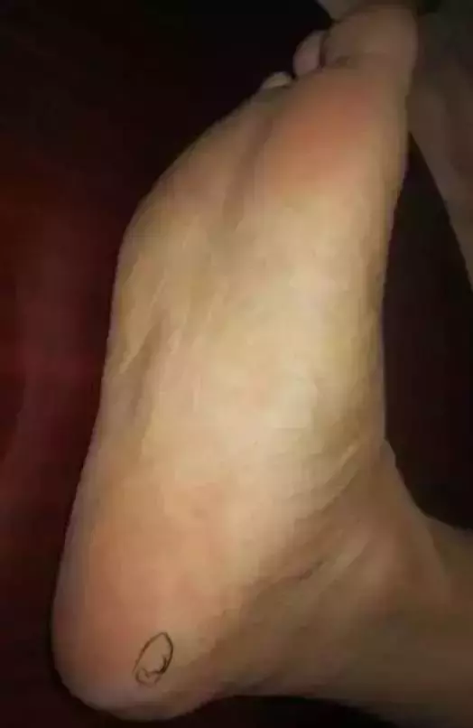 專家推薦:治腰疼、頸椎疼、膝蓋疼,一病一招!太珍貴了~