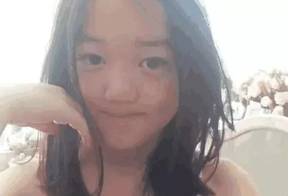 李嫣第三次兔唇微整,術後顏值恢復,網友:看完照片不想說話了