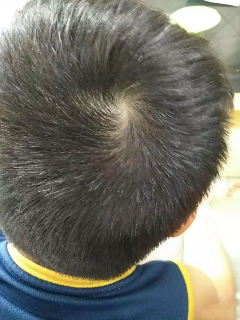為什麼有人頭上只有一個旋，有人卻有兩個？看完漲知識了！ 