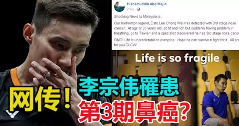 網傳李宗偉罹患第3期鼻癌 羽總會長不欲置評
