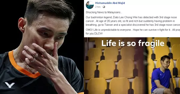 網傳李宗偉罹患第3期鼻癌 羽總會長不欲置評