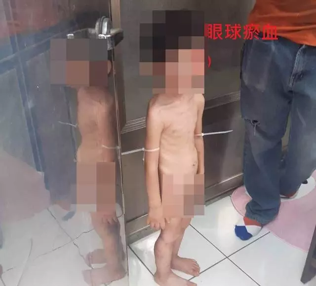新竹市 怒!皮包骨男童抓屎吞 母控:生父新歡絕情凌虐