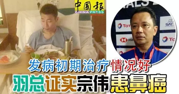 發病初期治療情況好羽總證實宗偉患鼻癌