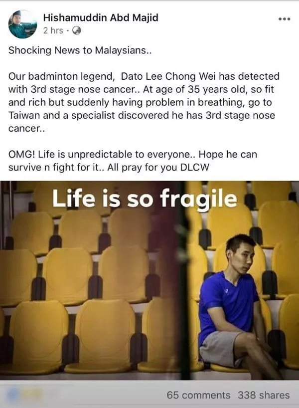 發病初期治療情況好羽總證實宗偉患鼻癌