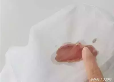 衣服不管染上什麼,用這招都能洗掉,太實用了!