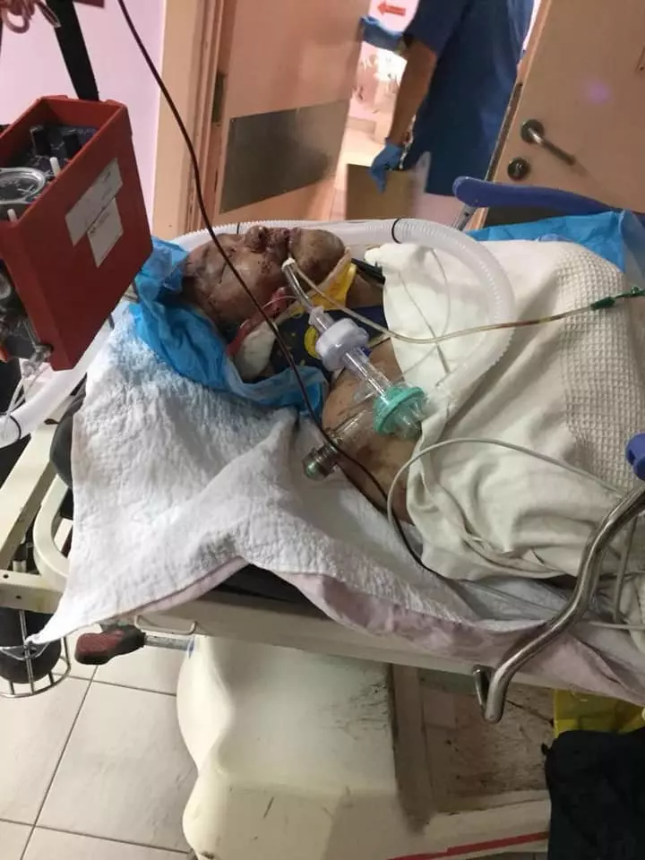 【今日瘋轉】酒駕把我哥撞重傷!現在不出來面對!還竟敢報假案?!請還我哥一個公道!