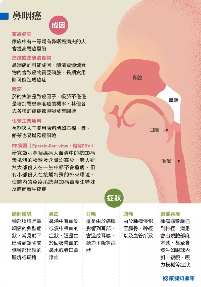 華裔男性最容易中!【鼻咽癌】到底是一種什麼病?不好好醫治會導致死亡?!
