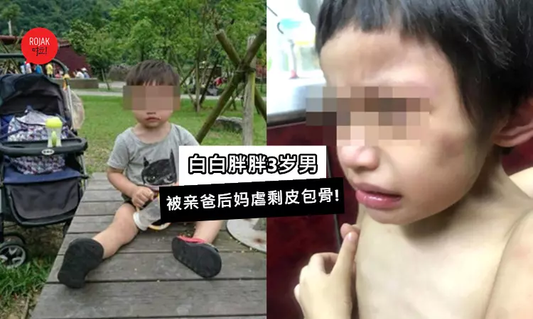 3歲男童被親生爸爸+同居女友綁在家裡吃屎!媽媽探視才驚覺男童瘦剩皮包骨也全身是傷……