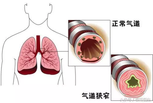 沒動兩下就氣喘吁吁,只是因為缺乏運動?