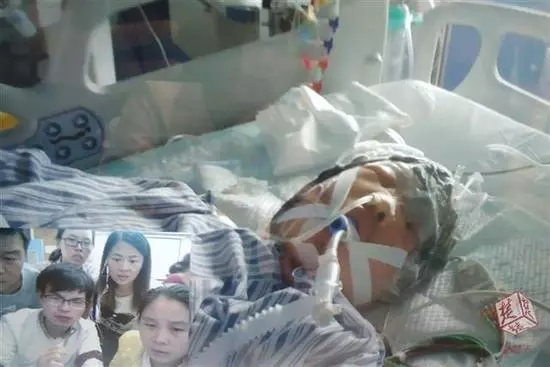 29歲農婦頭發捲入收割機 整個頭皮被生生撕扯下