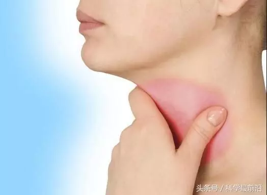 【李宗偉患癌】什麼是鼻咽癌?如發現有這7個症狀,你就要注意了!