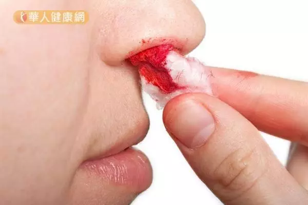 【李宗偉患癌】什麼是鼻咽癌?如發現有這7個症狀,你就要注意了!