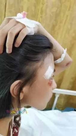 摩哆疑闖斑馬線紅燈 女寬中生被撞傷