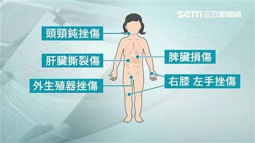 女童疑遭虐死…生母嗆記者:拍我就告