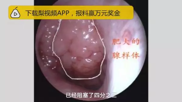 夫妻倆都是高顏值「女兒卻越長越醜」,丈夫懷疑「被戴綠帽」!結果做完親子鑑定後…他愧疚不已!