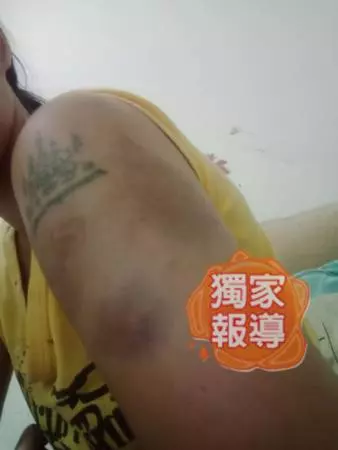 老婆講錯一句話 老公揮拳 斷鼻樑