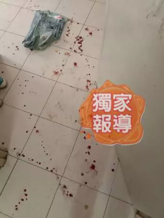 老婆講錯一句話 老公揮拳 斷鼻樑