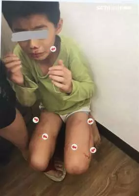 男童遭虐打 泣訴:媽媽對狗比對我好