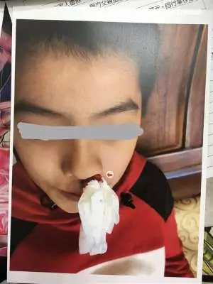 男童遭虐打 泣訴:媽媽對狗比對我好