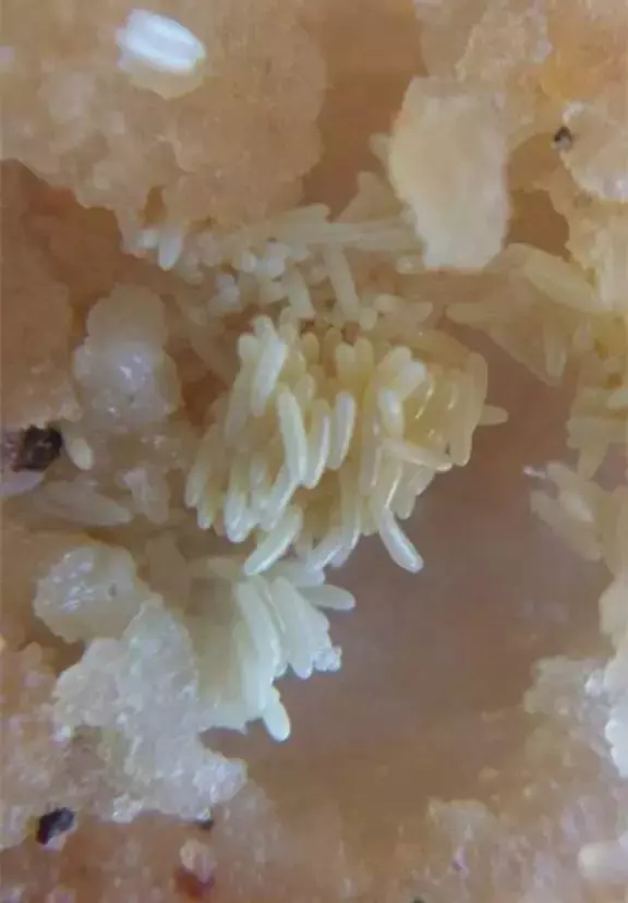 密集恐懼症有救啦,這裡有完善的治療方法!