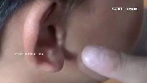 小四生遭老師狠K腦震盪 家長怒告!