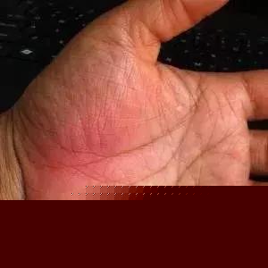 手掌上這塊肉,一看就知道你身體好不好,很靈哦!